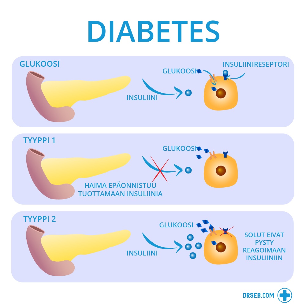 2 Tyypin Diabetes Parantuminen
